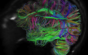 Human Brain Wallpaper 36897